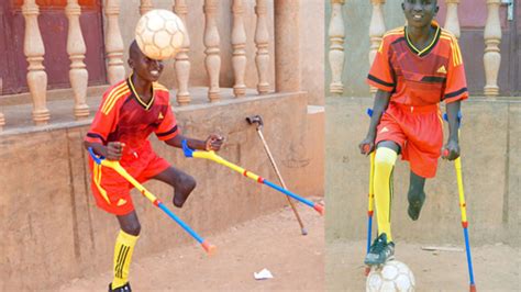 Ojok The Amputee Football Star Daily Monitor
