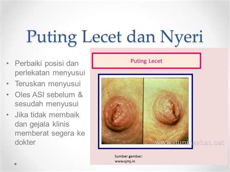 Cerita ini dari pengalaman teman 28 tahun yang lalu. Ask Your Dietitian