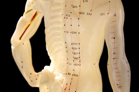 Maybe you would like to learn more about one of these? Alternative Treatments for Sciatica: Acupuncture ...