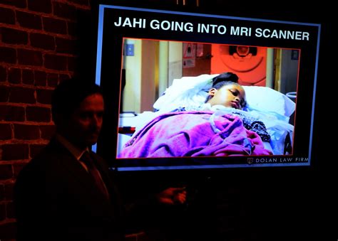 Jahi Mcmath Improved After She Was Declared Brain Dead Doctors Say