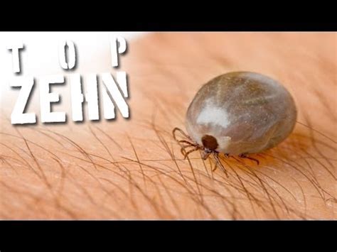 We did not find results for: 10 unglaublich beunruhigende Parasiten - YouTube