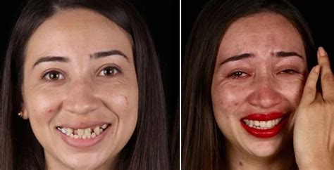 Dentist Gives Free Dental Makeovers And Shares The Incredible Before