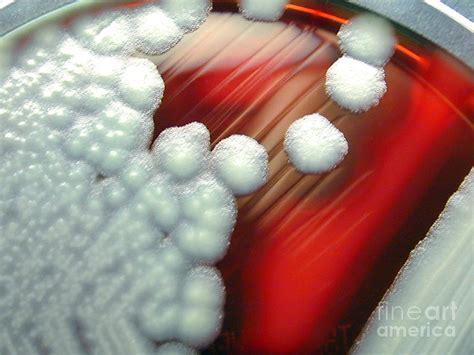 Bacillus Cereus Culture Photograph By Science Source Fine Art America