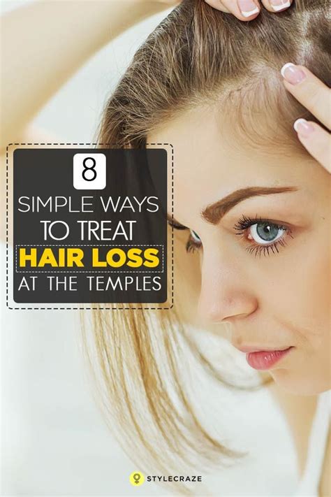 Female pattern hair loss is the most common hair disorder in women. 8 Simple Ways To Treat Hair Loss At The Temples | Temple ...