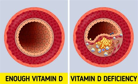 Warning Signs That You Are Lacking Vitamin D Creativeside