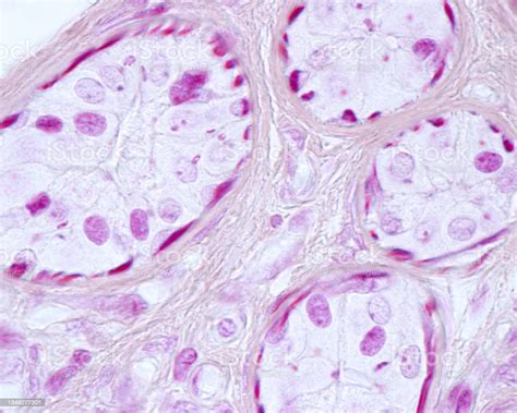 Human Sweat Gland Myoepithelial Cells Mallory Stain Stock Photo