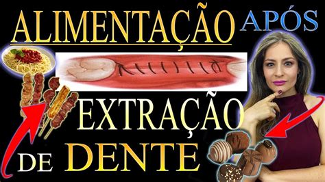 EXTRAI um Dente o que posso COMER Saiba o que comer após uma extração