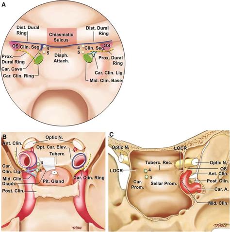Sphenoid Sinus Anatomy Anatomynote Com Sinusitis Brain Anatomy