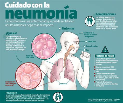 Por lo general, la enfermedad de stargardt se transmite de padres a hijos. Salud.21: Cuidado con la neumonía Salud | Peru21