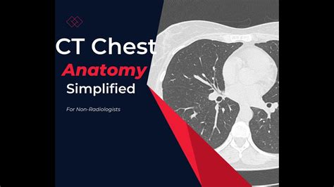 Ct Chest Anatomy Made Simple For Medical Students Residents And