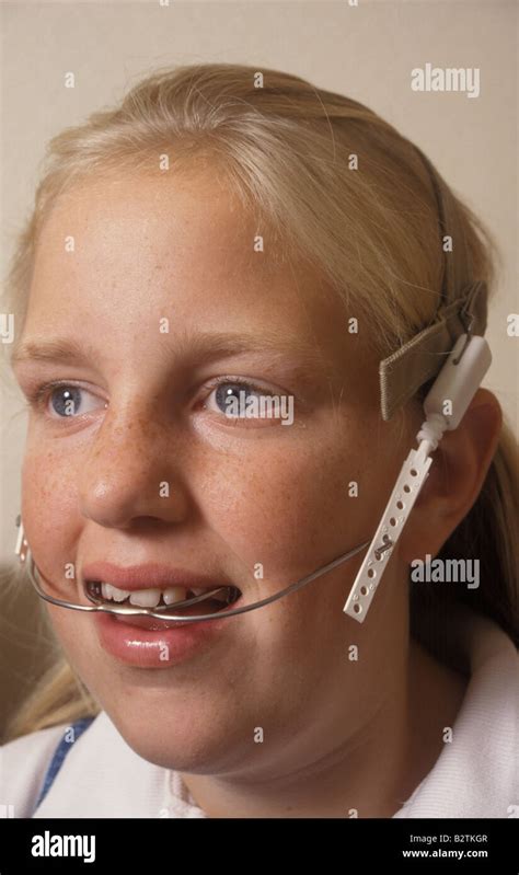 Girl Wearing Braces With Headgear Stock Photo Alamy