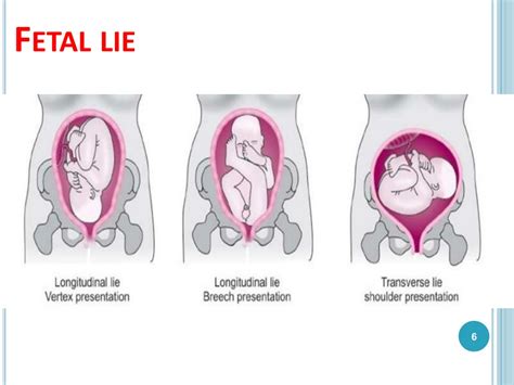 Ppt Fetal Position And Presentation Powerpoint Presentation Free