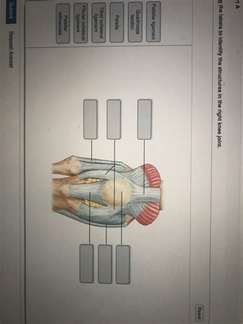 These bony plates cover the brain and are held together by fibrous material called sutures. Solved: - Part A Drag The Labels To Identify The Structure ...