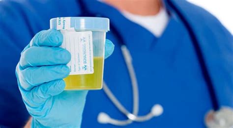 Exame de urina pode determinar o sexo do bebê Fetalmed Medicina
