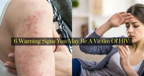 It has claimed a countless number of lives and continue to do so as the said illness currently does not have any confirmed cure or medicine that can directly alleviate or eliminate the virus itself. Early Signs Of HIV- 6 Warning Signs You May Be A Victim Of ...