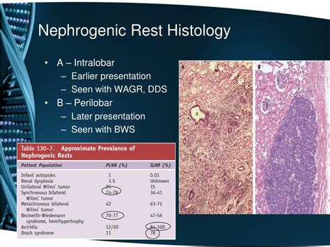 Ppt Pediatric Abdominal Tumors A Focus On Wilms Tumor Powerpoint