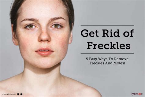 Get Rid Of Freckles 5 Easy Ways To Remove Freckles And Moles By Dr Deepak Kothari Lybrate