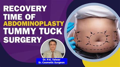 How Long Does It Take To Recover After Abdominoplasty Tummy Tuck Surgery Know From The