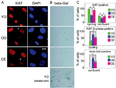 Staining method of cells and tissues is detailed. CE fibroblasts are not senescent cells. (A ...