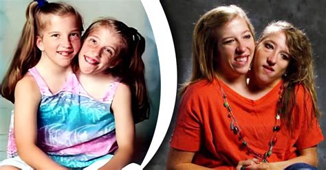Heres What Former Tlc Stars Conjoined Twins Abby And Brittany Hensel