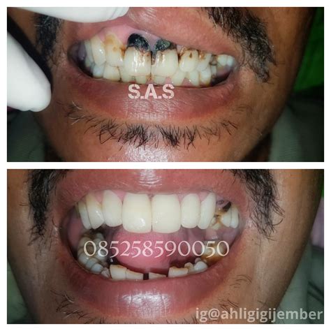 S.A.S - AHLI GIGI KOTA PATI, Jateng & KOTA JEMBER, Jatim: Koleksi Foto