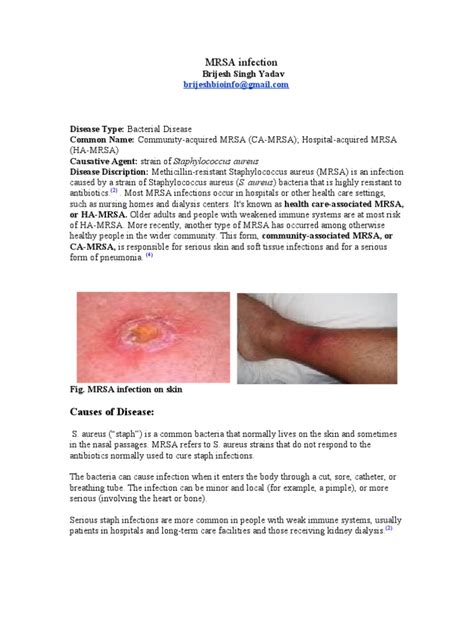 Types Of Skin Infections Common Skin Infections In Summer