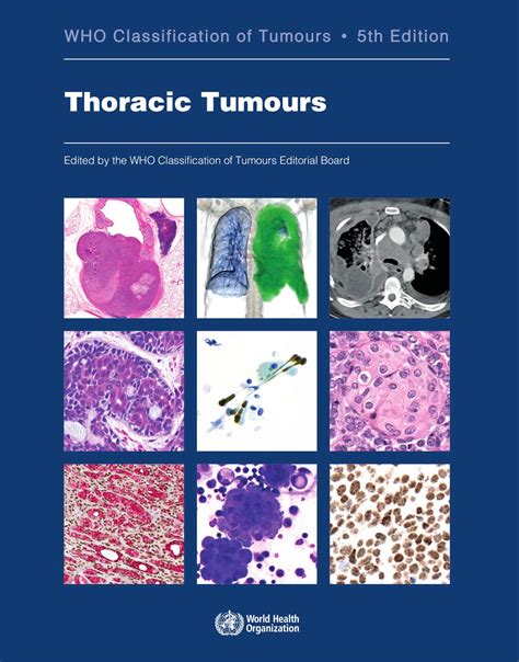 Who Classification Of Tumours 5e Vol 5 Thoracic Tumours
