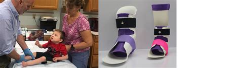 Pediatric Orthotic Specialists Providing Its Patients With Increased