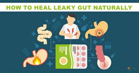 How Do I Heal A Leaky Gut A Functional Medicine Approach