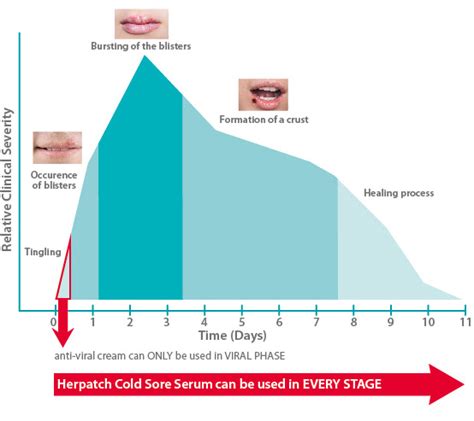 Herpatch The Solution For Your Cold Sores And Mouth Ulcers Cold
