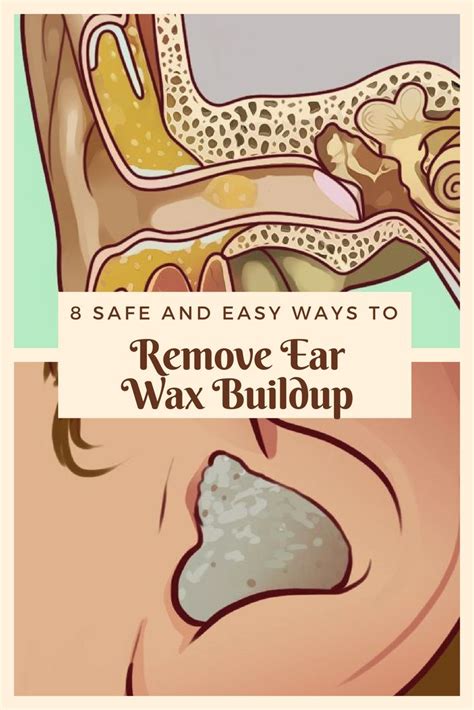 Inevitably, using earbuds to immerse yourself in your favourite tunes, games podcasts and. 8 safe and easy ways to remove ear wax buildup | Ear wax ...