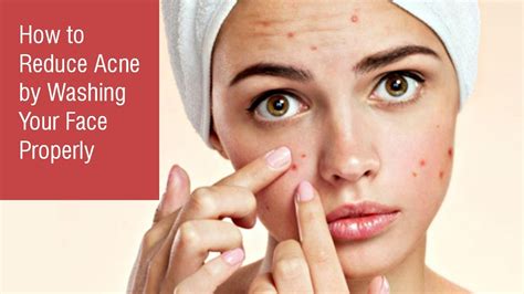 How To Avoid Acne By Washing Your Face Properly Youtube