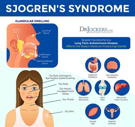 Sjogrens Syndrome Symptoms Causes And Natural Support Strategies In
