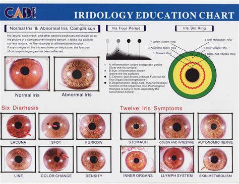 Iris Reading Chart How To Read Iriscope Iridology Camera