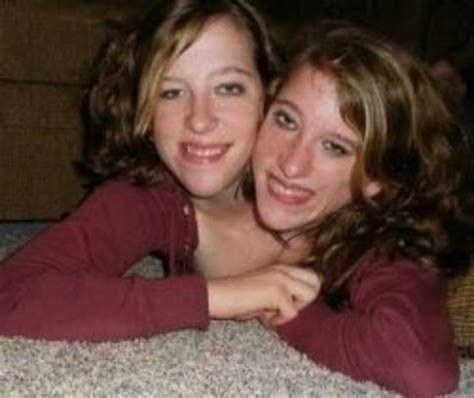 Abigail And Brittany Hensel