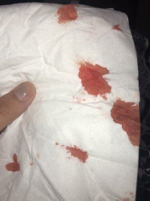 During the first 9 weeks of pregnancy, there can be poor spotty discharge, which can appear when a woman used to have. BLEEDING DURING PREGNANCY?? (PHOTO ATTACHED) - Pregnancy after loss - BabyCenter Australia