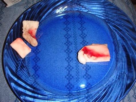 Check spelling or type a new query. Wisdom Tooth Removal Tips Photos