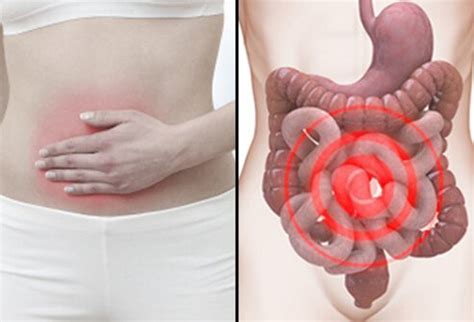 Among the internal they are two organs of the body located in the lower back or posterior area of the abdomen. What's Causing Your Abdominal Pain?