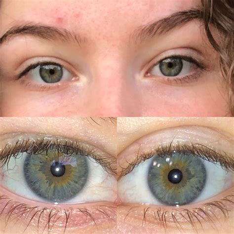 How Rare Are Grey Eyes With Central Heterochromia Quora