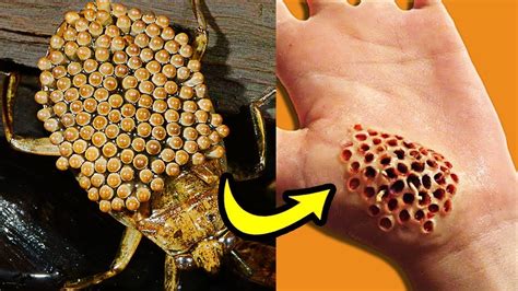 10 Most Dangerous Bugs In The World Youtube