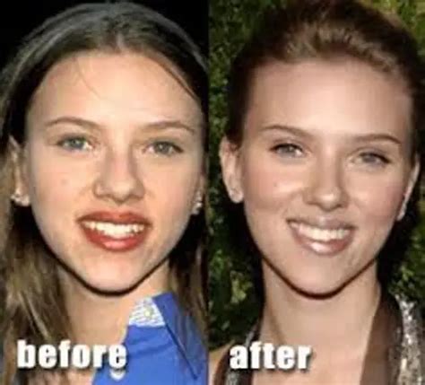 8 Interesting Plastic Surgery Facts My Interesting Facts