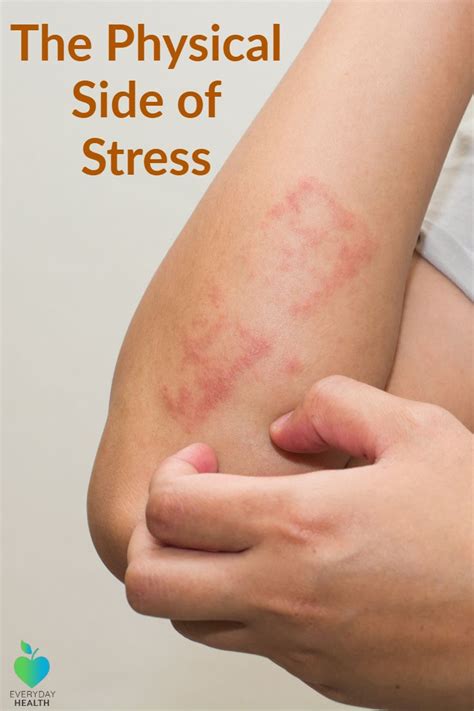 The Physical Side Of Stress Essential Oils For Stress Stress