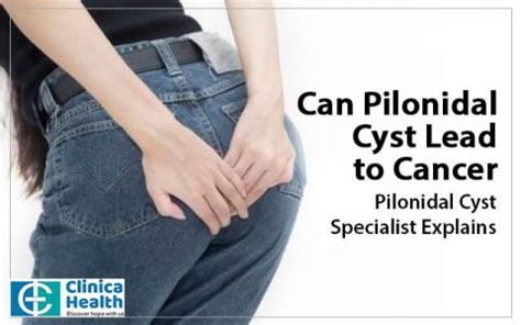 Pilonidal Cyst Surgeon Explains Can It Cause Cancer