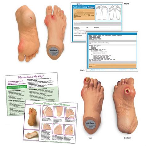 Lifeform Common Foot Problems Kit
