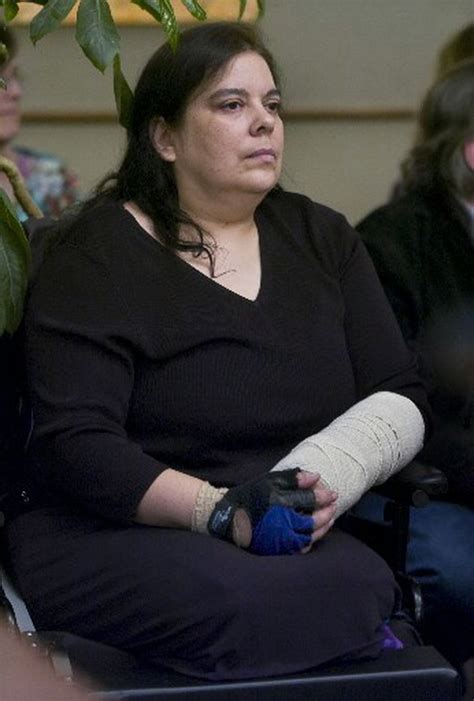 Woman Who Lost Both Legs In Crash Sues Driver And His Employer