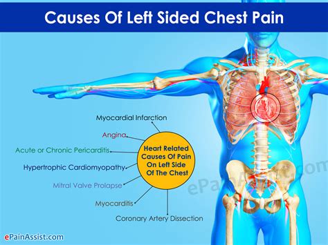What Does Left Sided Chest Pain Indicate