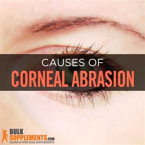 Corneal Abrasion Symptoms Causes And Treatment