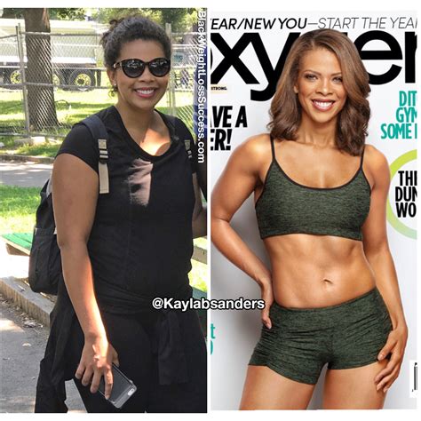 Is weight loss surgery ever covered by insurance? Kayla lost 45 pounds | Black Weight Loss Success