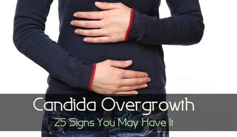 Candida Overgrowth 25 Signs You May Have It