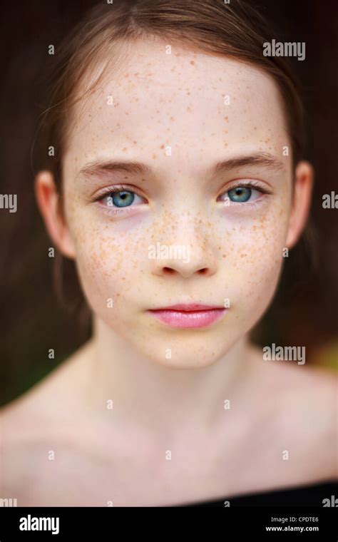 A Close Up On A Young Freckled Girls Face Looking At The Camera Stock